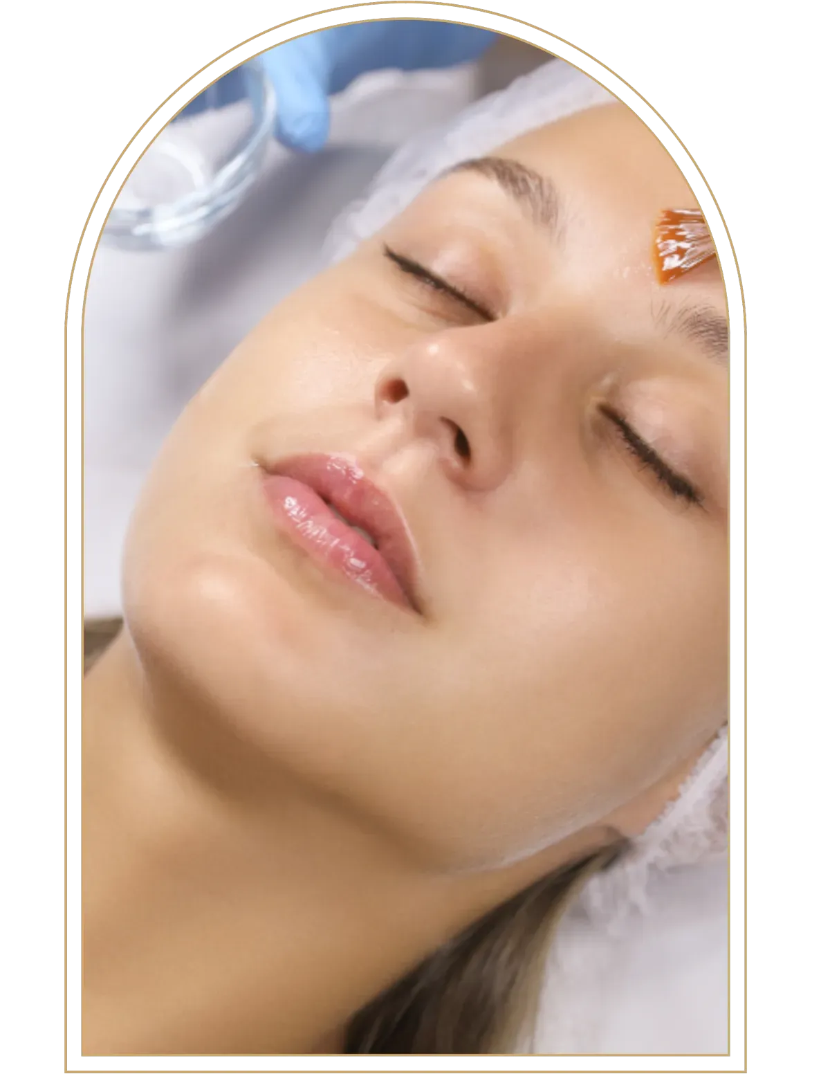 Medical Grade Tween Facial